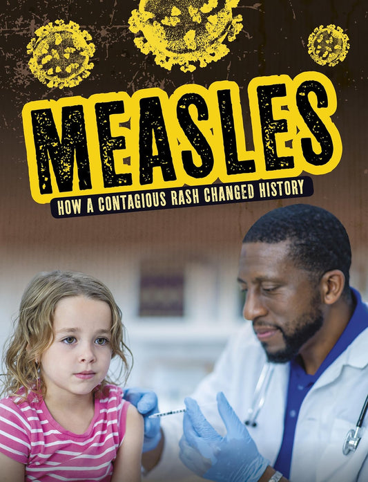 Measles: How A Contagious Rash Changed History by Mark K. Lewis