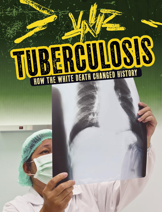 Tuberculosis: How The White Death Changed History by Mark K. Lewis